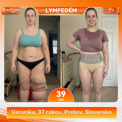 🎉🎁𝑶𝒇𝒊𝒄𝒊á𝒍𝒏𝒚 𝒐𝒃𝒄𝒉𝒐𝒅 𝒛𝒏𝒂č𝒌 |🫛🦔𝐕𝐄𝐋𝐍𝐎𝐑𝐀® 𝟐𝟎𝟐𝟔 𝑴𝑶𝑹𝑰𝑵𝑮𝑨 & 𝑩𝑬𝑹𝑩𝑬𝑹Í𝑵 4 𝑽 1 𝑴𝑰𝑲𝑹𝑶Č𝑨𝑺𝑻𝑰𝑪𝑶𝑽É 𝑭𝑶𝑹𝑴𝑶𝑽𝑨𝑵𝑰𝑬 & Š𝑶𝑹𝑻𝑲𝒀 𝑵𝑨 𝑺𝑷𝑨Ľ𝑶𝑽𝑨𝑵𝑰𝑬 𝑻𝑼𝑲𝑼 👨‍⚕️